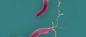 Helicobacter: The Bacteria that Cause Ulcers